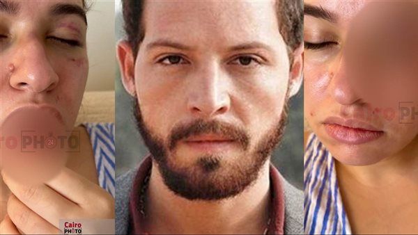للاعتداء على زوجته.. تخفيف الحكم على الفنان محمود حجازي من 6 أشهر سجن إلى شهر 
